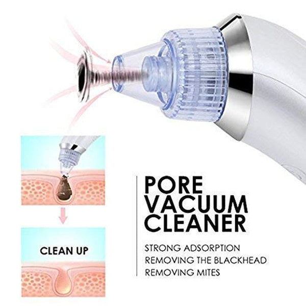 Next Generation Acne Remover Skin Cleaner